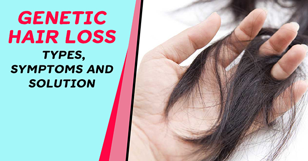 Ursachen für genetischen Haarausfall