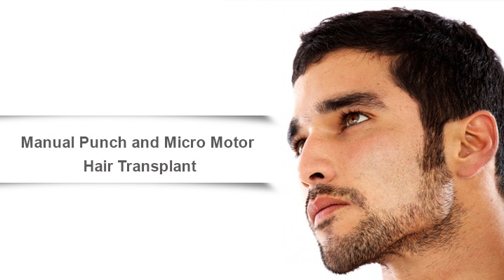 Diferencias entre punzón manual y micromotor