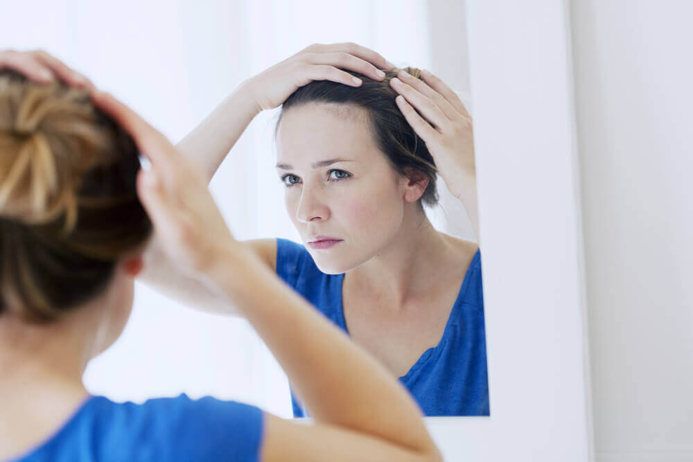 female pattern hair loss