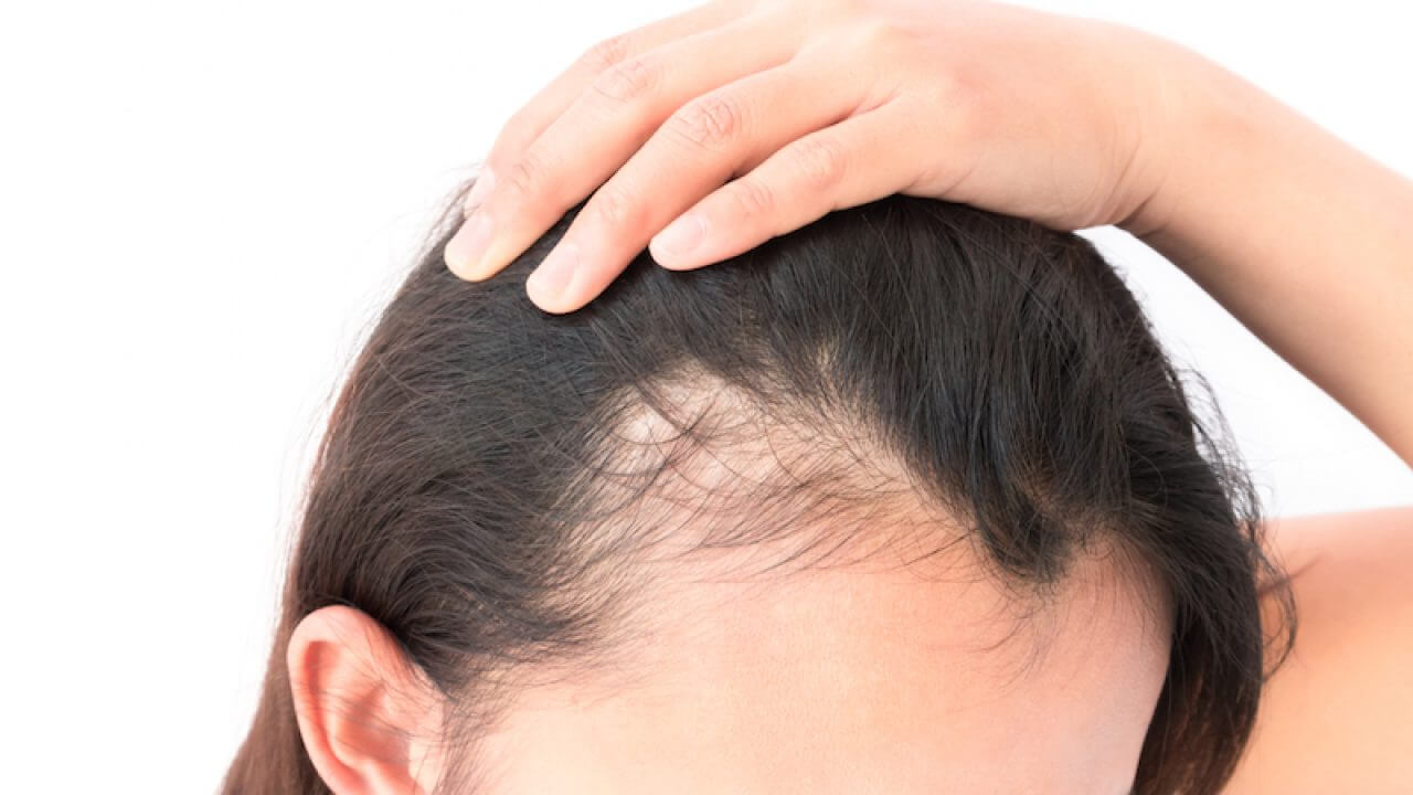 hair loss during pregnancy