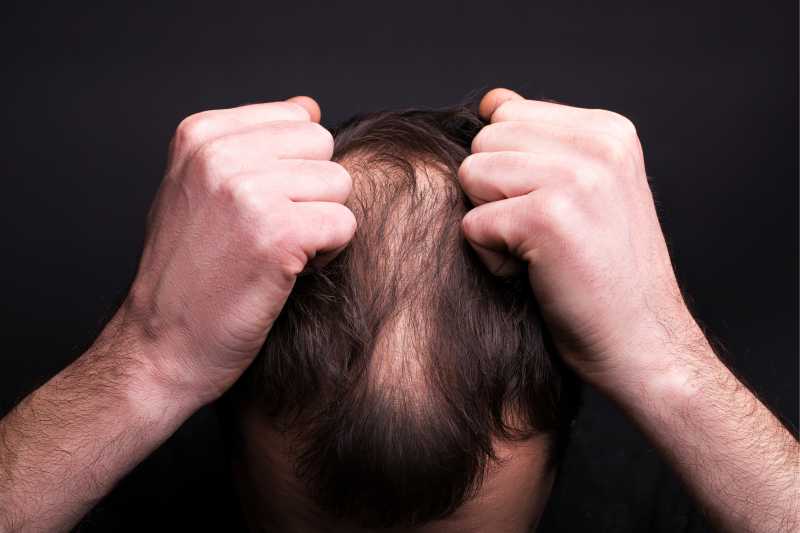 stress de perte de cheveux