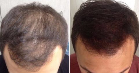 resultados de simulación de cabello