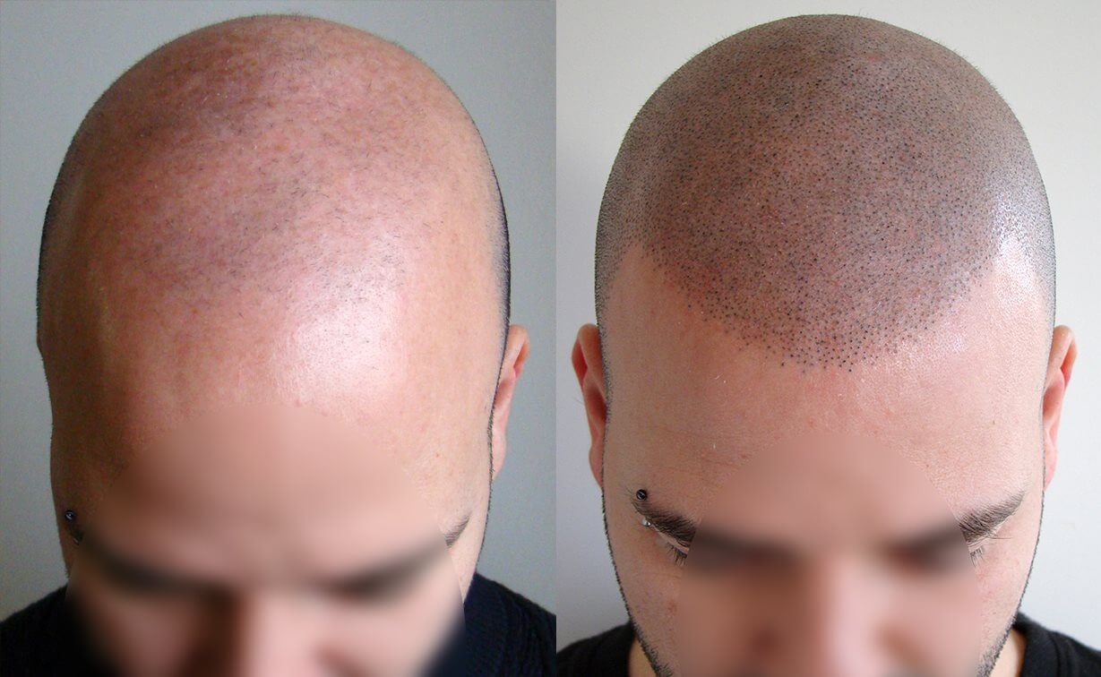 tatuaje de simulación de cabello