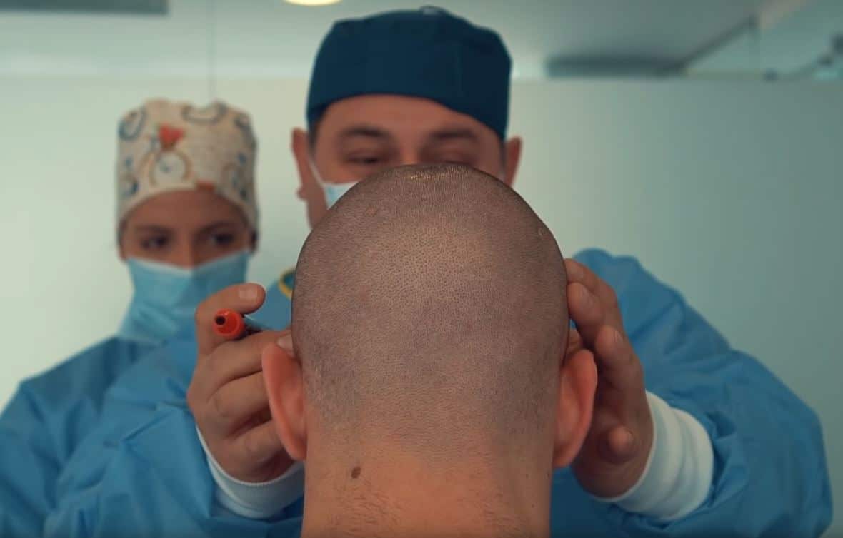Haartransplantationsklinik