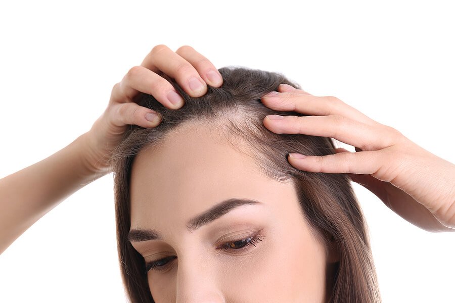 Gibt es eine Lösung für genetischen Haarausfall?