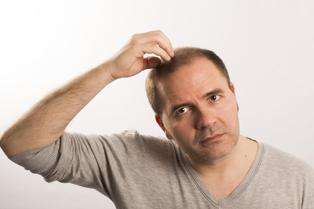 itching after hair transplant
