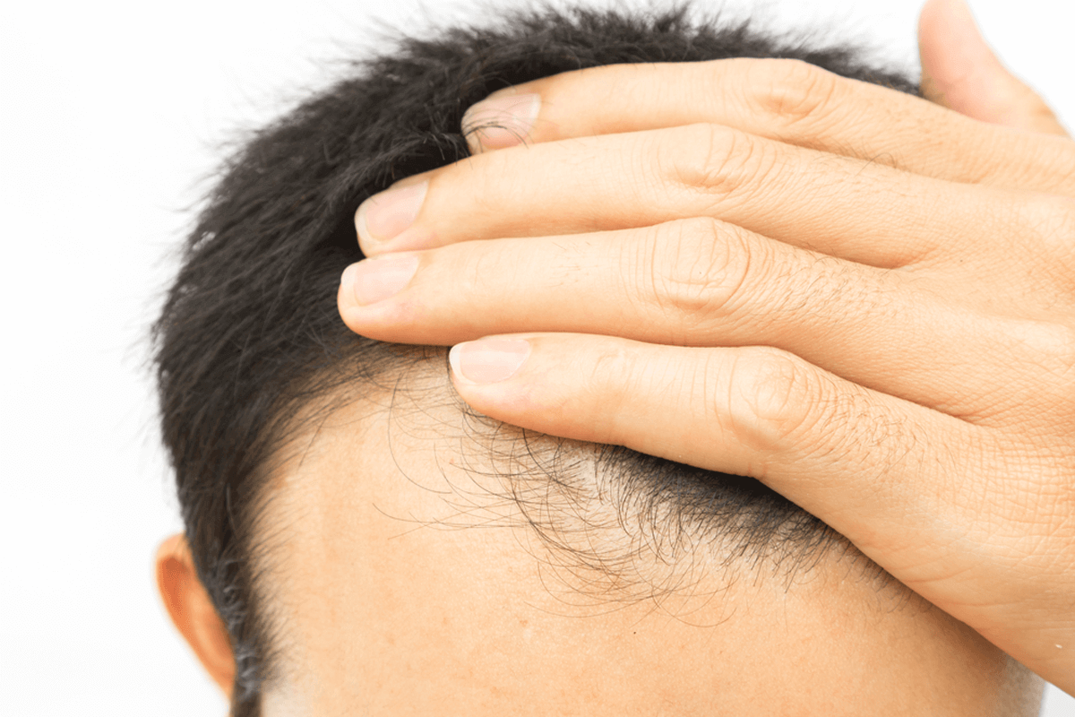 itchy head after hair transplant
