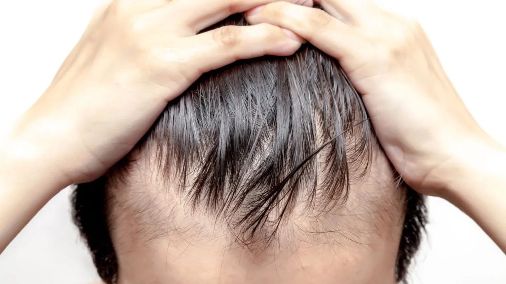 Lösung gegen Haarausfall