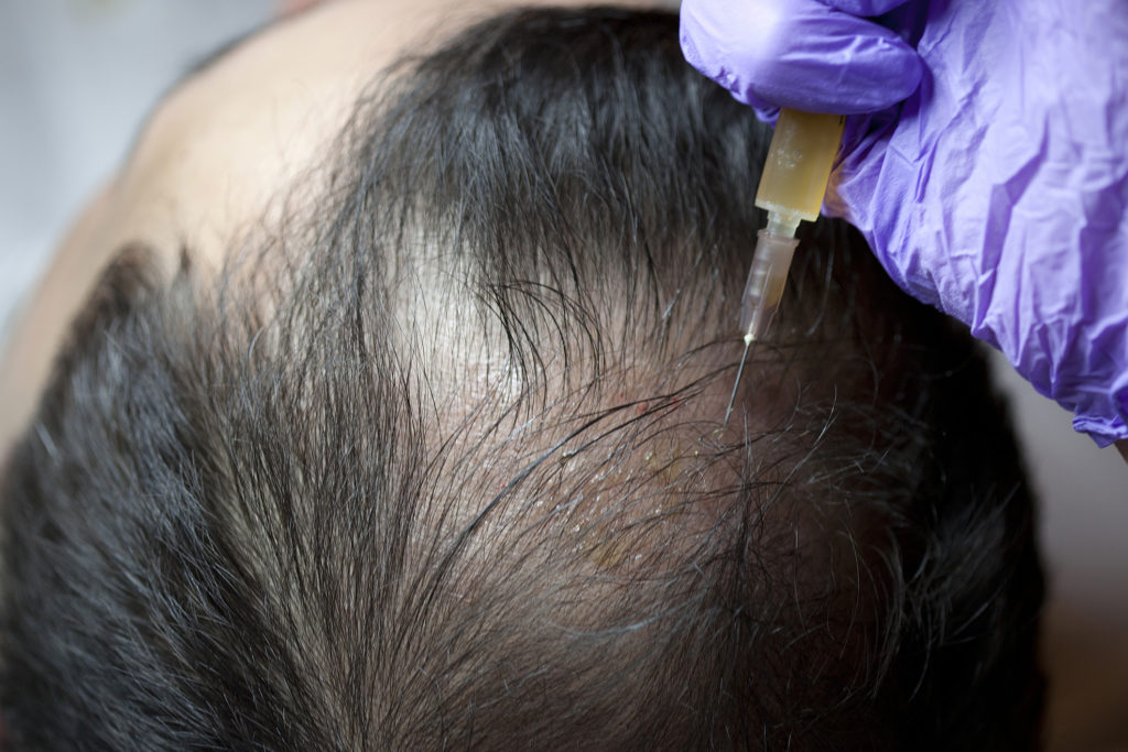 terapia con células madre antes después