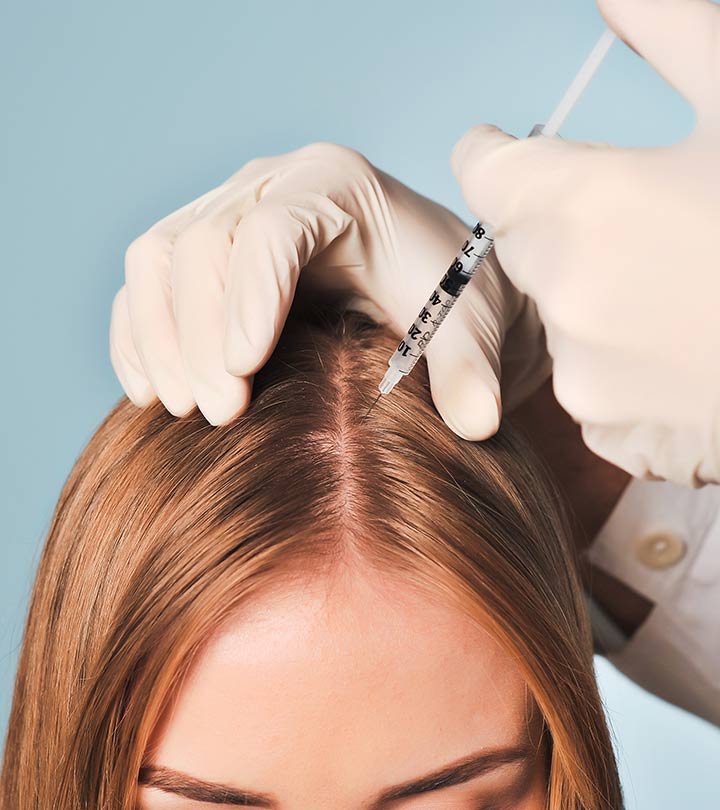 mesoterapia per capelli