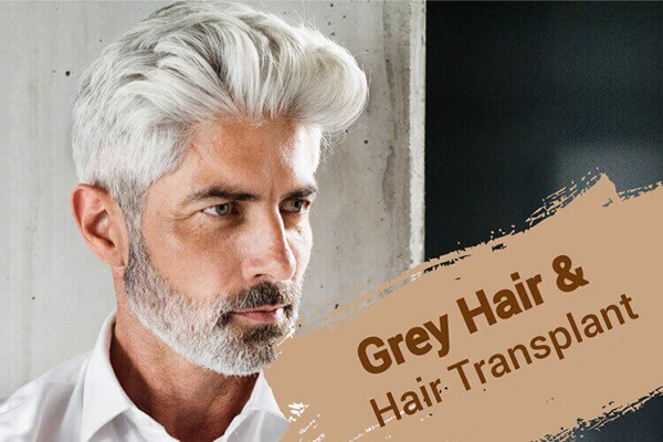 White hair transplant