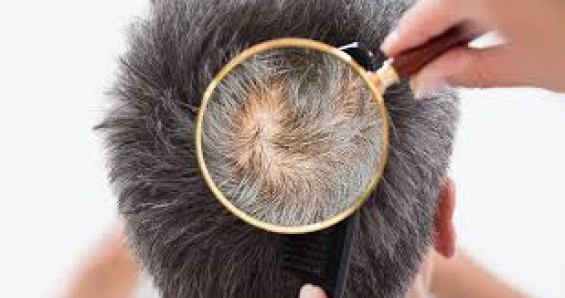 saç analizi nedir